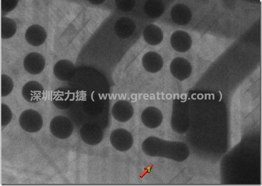 BGA因?yàn)楹笁|變小，造成錫膏過多而最終形成焊接短路的結(jié)果。